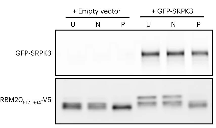 Open access visualization of Gel, RBM20, GFP-SRPK3, 293T Cells, Hyperphosphorylation