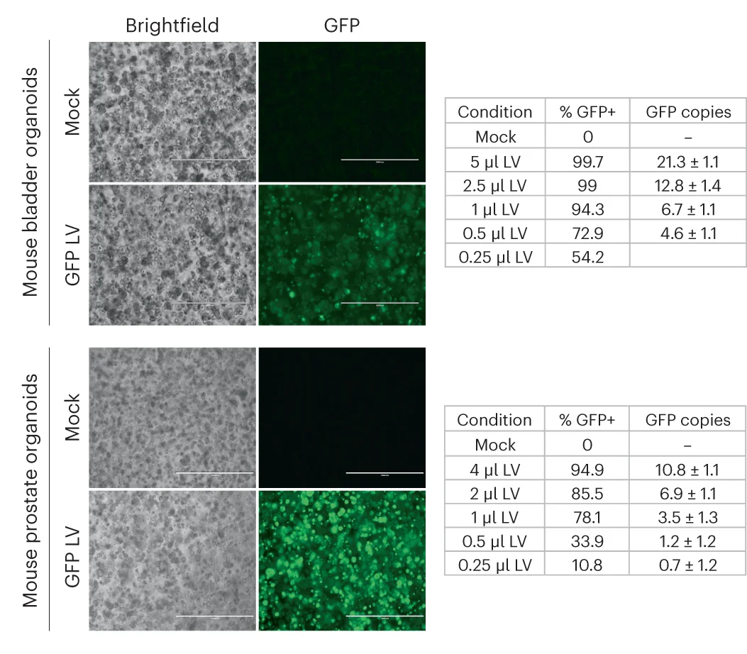 Open access visualization of Microscopy, Table Image, Brightfield, GFP Images, Mouse Bladder
