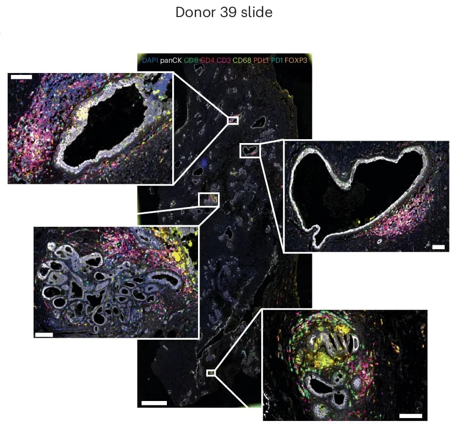 Open access visualization of Microscopy, Ultivue Staining, DAPI, PanCK, CD8
