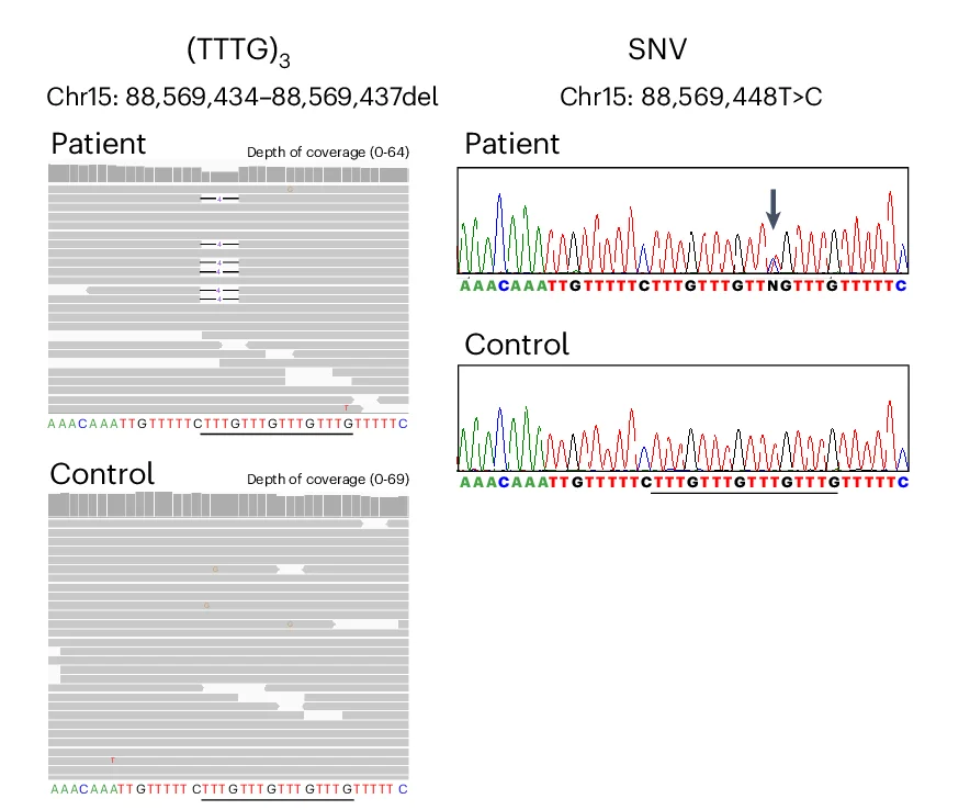 Open access visualization of Line Plot, Integrative Genomics Viewer, Electropherograms, TTTG, SNV