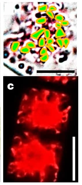 Open access visualization of Microscopy, Chromosome Counting, Light Micrographs, Prophase, Metaphase