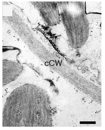Open access visualization of Microscopy, Transmission Electron Microscopy, Cross Wall, Chloroplast Lobes, Cell Structure