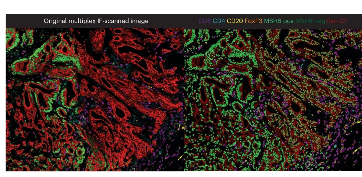 Open access visualization of Microscopy, Segmented MIF Image, MSH6-proficient, MSH6-deficient, Tumor Subclones