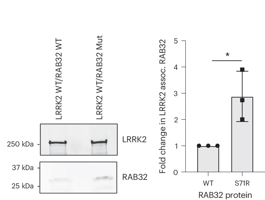 Open access visualization of Bar Plot, Error Bars, Gel, LRRK2, RAB32