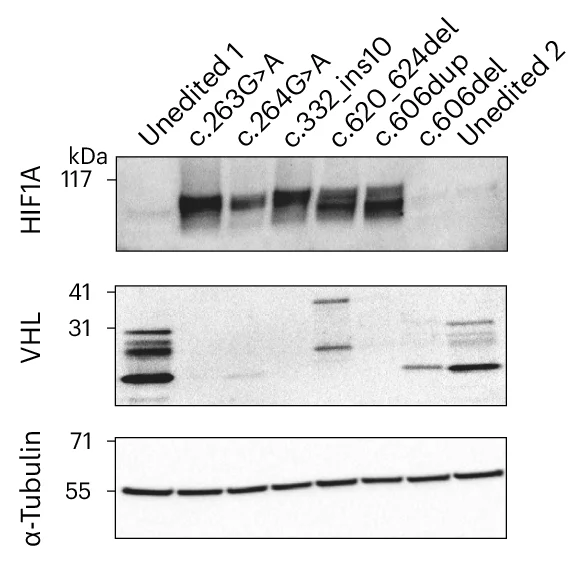 Open access visualization of Gel, Western Blot, VHL, HIF1A, Protein Expression