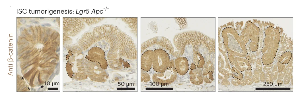 Open access visualization of Microscopy, β-Catenin IHC, Intestinal Tumors, Lgr5+ ISCs, PCs