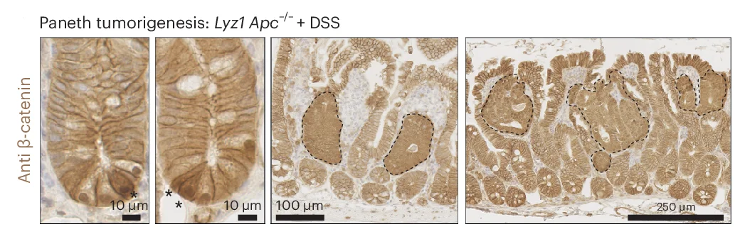 Open access visualization of Microscopy, β-Catenin IHC, Intestinal Tumors, PCs, Lgr5+ ISCs
