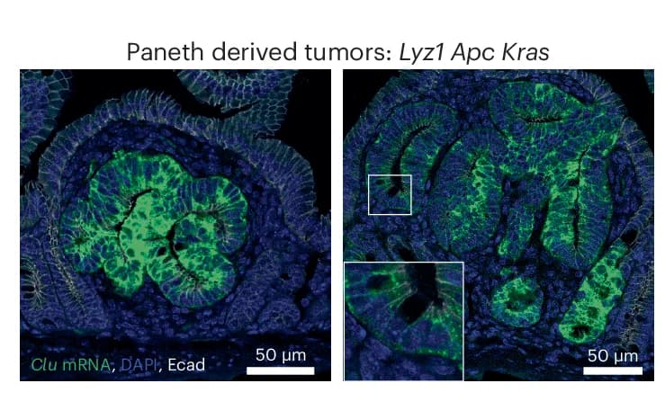Open access visualization of Microscopy, RNA In Situ Hybridizations, Clu Gene, Small Tumors, PC