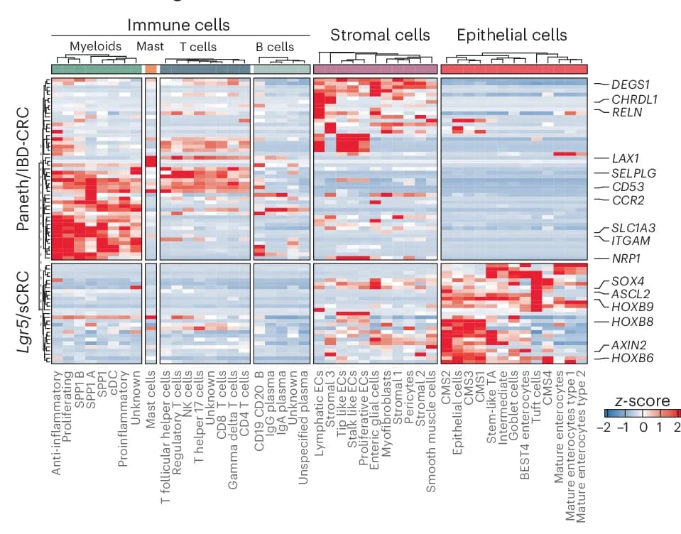 Open access visualization of Heatmap, Clustered, Differentially Expressed Genes, Paneth Tumors, IBD Tumors