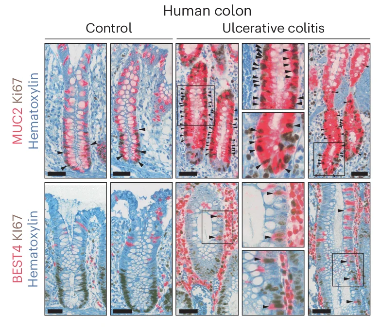 Open access visualization of Microscopy, MUC2, BEST4, Ki67, IHC