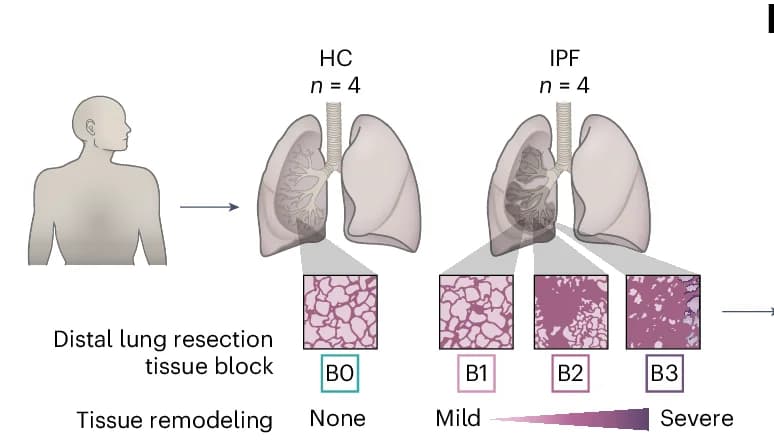 Open access visualization of Workflow, Illustration, Tissue Sections, Lung Resection Samples, Healthy Controls