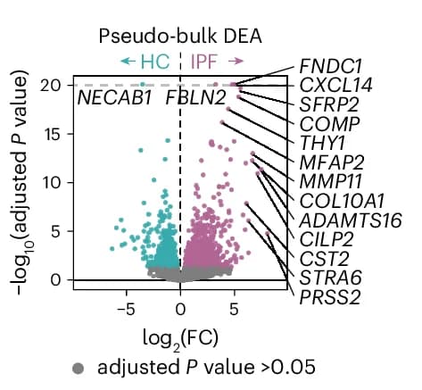 Open access visualization of Volcano Plot, Scatter Plot, Pseudobulk DEA, Healthy Controls, IPF