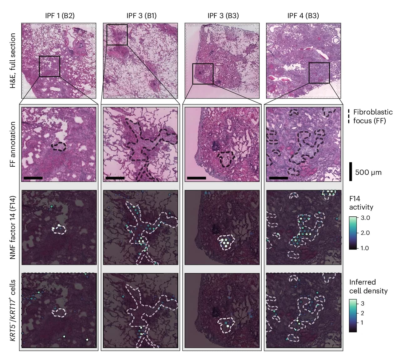 Open access visualization of Microscopy, FF Annotations, F14 Activity, KRT5 Cells, KRT17 Cells
