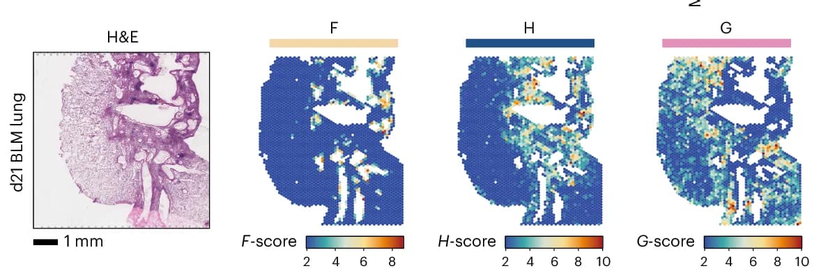 Open access visualization of Microscopy, Heatmap, Compartment Scores, Cell-Type Densities, BLM d21 Lung Section