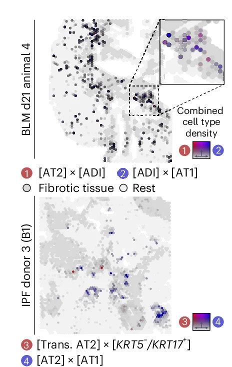 Open access visualization of Scatter Plot, Heatmap, Spatial Colocalization, AT2 Cells, Krt8+ ADI Cells