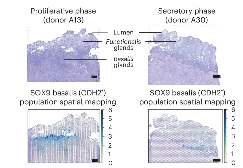 Open access visualization of Microscopy, Heatmap, Visium Spatial Transcriptomics, H&E Image, Cell Density