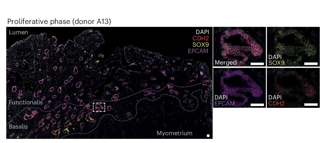 Open access visualization of Microscopy, smFISH, Whole-Uterus Biopsy, DAPI, EPCAM