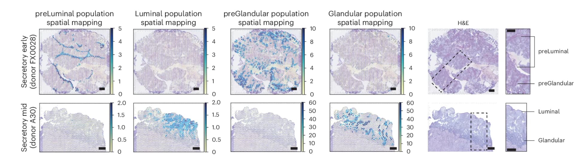 Open access visualization of Microscopy, Visium Spatial Transcriptomics, H&E Image, Cell Density, preLuminal