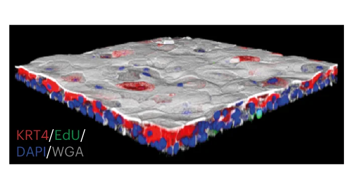 Open access visualization of Microscopy, Confocal Microscopy, Z-Stack, Epithelioid, EdU