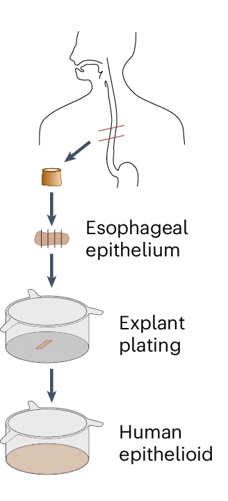 Open access visualization of Workflow, Illustration, Epithelioid, Human Esophagus