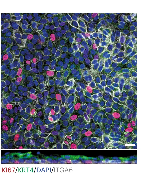 Open access visualization of Microscopy, Basal Layer, Lateral View, Mouse Oral Mucosa Epithelioid, KI67