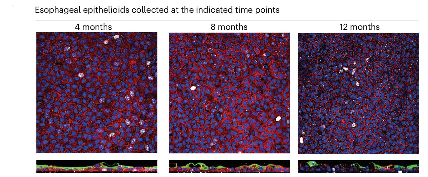 Open access visualization of Microscopy, Confocal Section, Basal Cell Layer, Lateral Views