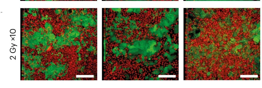 Open access visualization of Microscopy, p53 Mutant, Esophageal Tumors, Epithelioid Protocol, Primary Wild-Type Cells