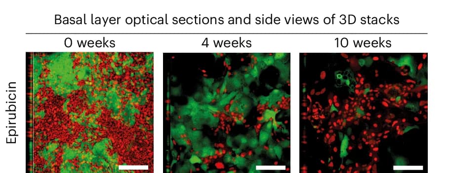 Open access visualization of Microscopy, p53 Mutant, Esophageal Tumors, Epithelioid Protocol, Primary Wild-Type Cells