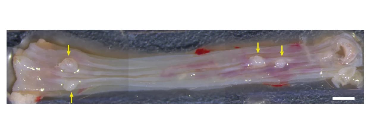 Open access visualization of Photo, DEN-Treated Esophagus, Tumors, Epithelium, Scale Bar