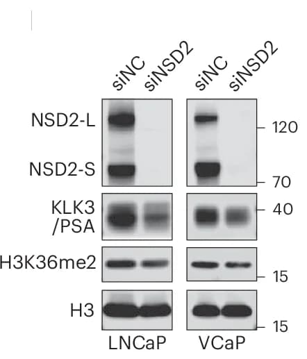 Open access visualization of Gel, Immunoblot, Proteins, siRNA Treatment, siNC
