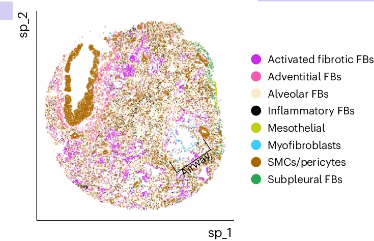 Open access visualization of Scatter Plot, UMAP, Mesenchymal Cells, Marker Gene Expression, Fibroblasts
