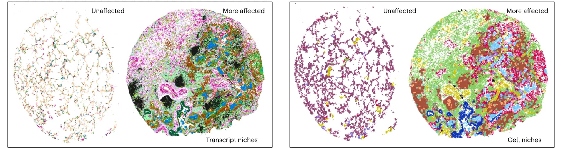 Open access visualization of Scatter Plot, Transcript Niches, Cell-Based Niches, Unaffected Samples, PF Samples