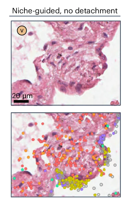 Open access visualization of Microscopy, Scatter Plot, Non-Detaching KRT5-/KRT17+ Cells, Activated Fibrotic Fibroblasts, Scale Bar