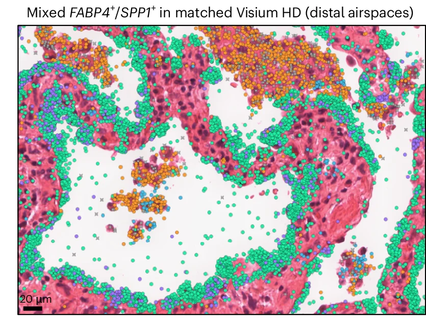 Open access visualization of Microscopy, Scatter Plot, Xenium Images, Visium HD Images, FABP4+ Macrophages