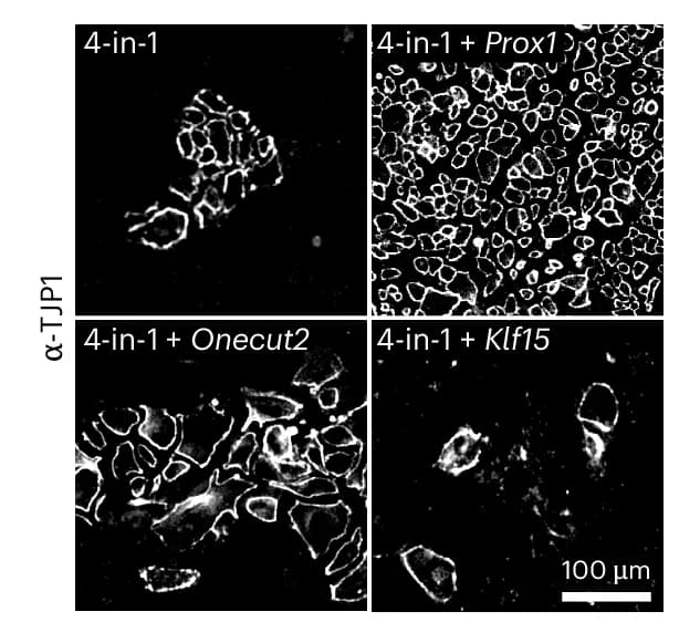 Open access visualization of Microscopy, TJP1, Immunofluorescence, Cell