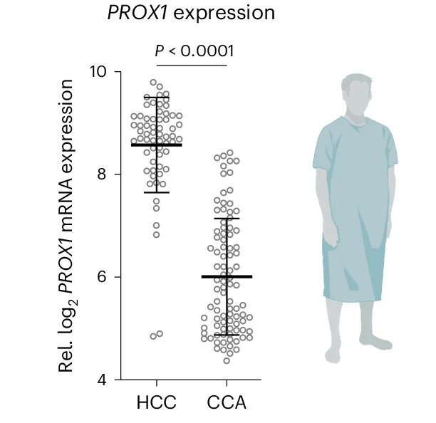 Open access visualization of Scatter Plot, Error Bars, PROX1 Expression, HCC, CCA