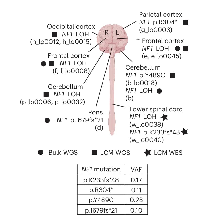 Open access visualization of Illustration, Table Image, Brain, Spinal Cord, Somatic NF1 Mutation