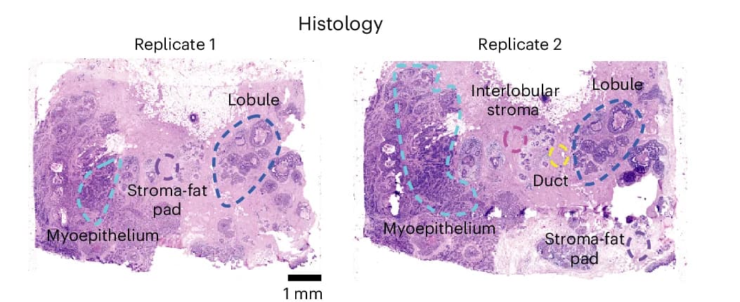 Open access visualization of Microscopy, H&E Slides, Breast Cancer, Tumor Resection