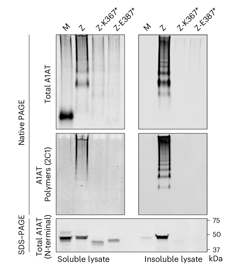 Open access visualization of Gel, SDS-PAGE, Native PAGE, Immunoblotting, Cell Lysate