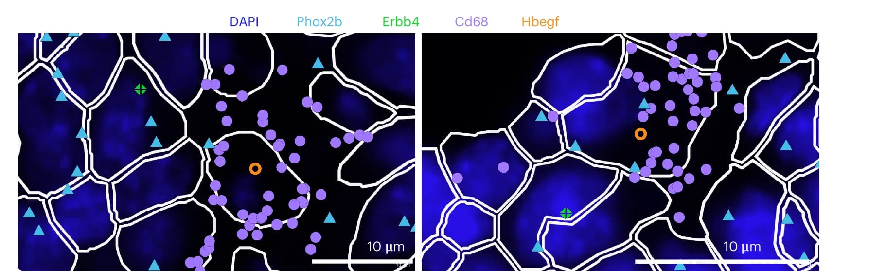 Open access visualization of Microscopy, Representative Image, Spatial Co-localization, Neuroblasts, Macrophages