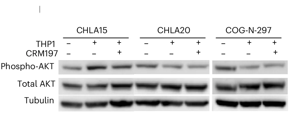 Open access visualization of Gel, Western Blots, AKT Phosphorylation, Neuroblastoma Cells, Macrophage Co-culture