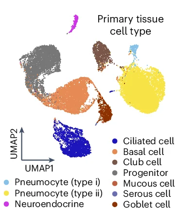 Open access visualization of UMAP, Scatter Plot, Lung Fetal, Lung Adult, Primary Tissue