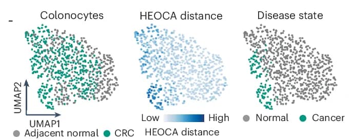 Open access visualization of UMAP, Scatter Plot, CRC, Adjacent Normal Colonocytes, Sample Type