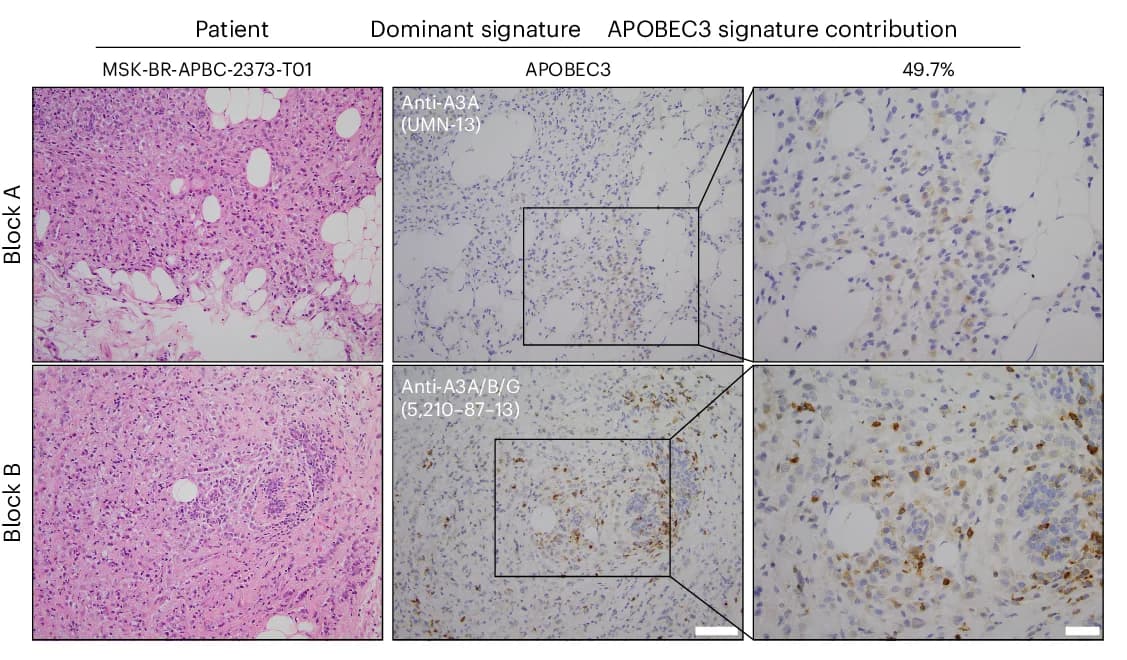 Open access visualization of Microscopy, Photo, Hematoxylin and Eosin Staining, Immunohistochemistry, A3A