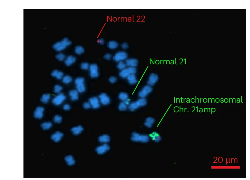 Open access visualization of Microscopy, Metaphase Spreads, Interphase Cells, Bone Marrow Cells, FISH
