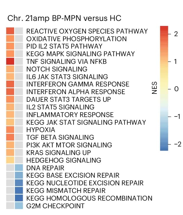Open access visualization of Heatmap, GSEA, KEGG, HALLMARK Pathways, chr. 21amp