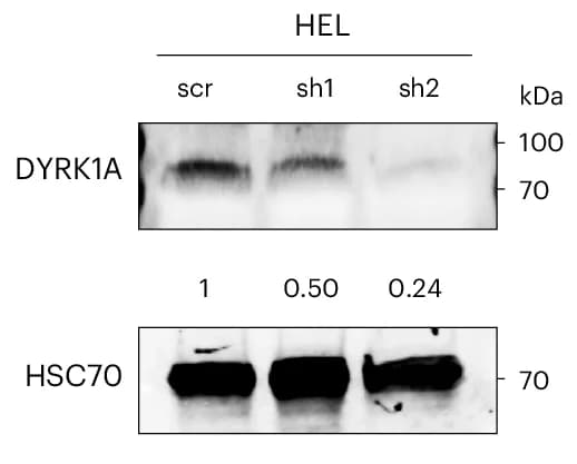 Open access visualization of Gel, Western Blot, DYRK1A, HEL Cells, shRNA