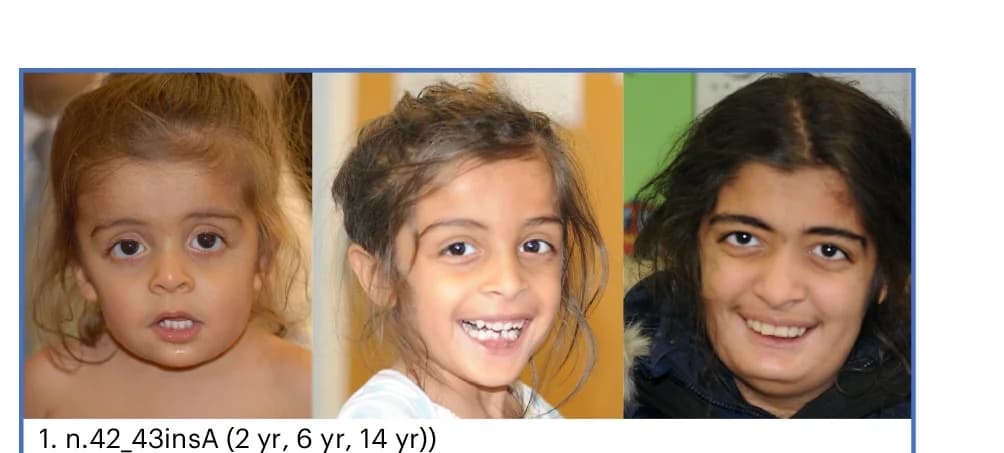 Open access visualization of Photo, Facial Photographs, MRI Images, Individuals, RNU5B-1