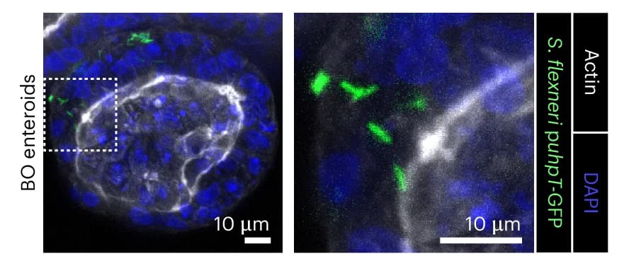 Open access visualization of Microscopy, Confocal Fluorescent Microscopy, BO Enteroid, Wild-type Shigella, Cytosolic Reporter