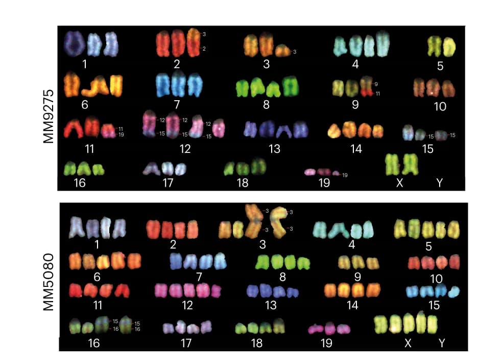 Open access visualization of Microscopy, Spectral Karyotyping, Metaphase Cells, Multiple Myeloma, Cell Lines